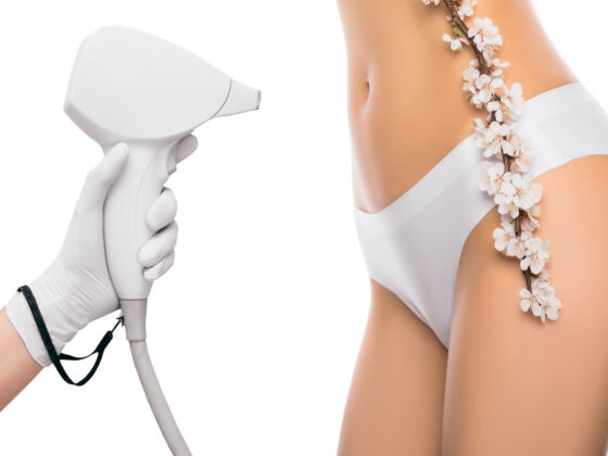 Épilation au laser ou lumière pulsée : quelles différences ?