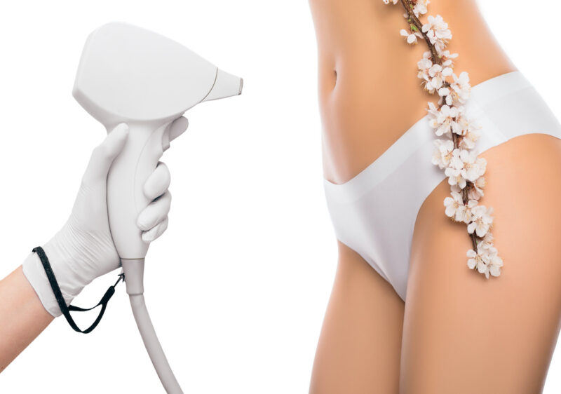 Épilation au laser ou lumière pulsée : quelles différences ?